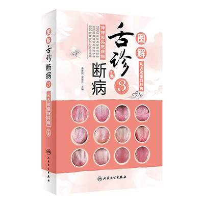 中醫(yī)婦科學(xué)舌診診斷